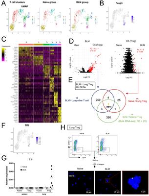 Tff1-expressing Tregs in lung prevent exacerbation of Bleomycin-induced pulmonary fibrosis